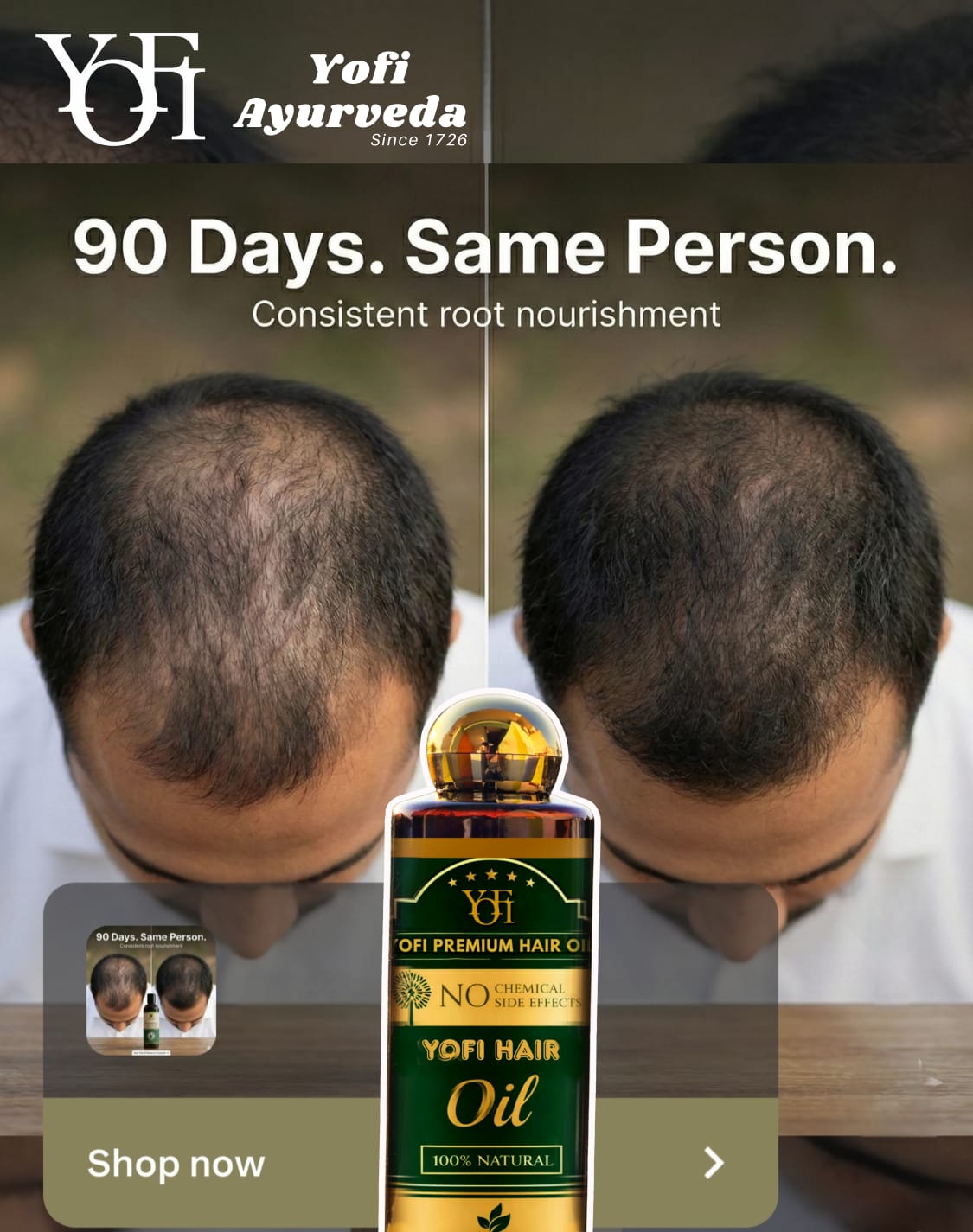 Yofi The 51+ Ingredients Herbal Hair Oil For Hair Care