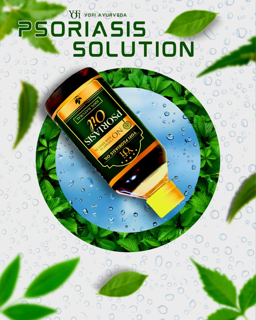YOFI Herbal Psoriasis -Clearing Oil