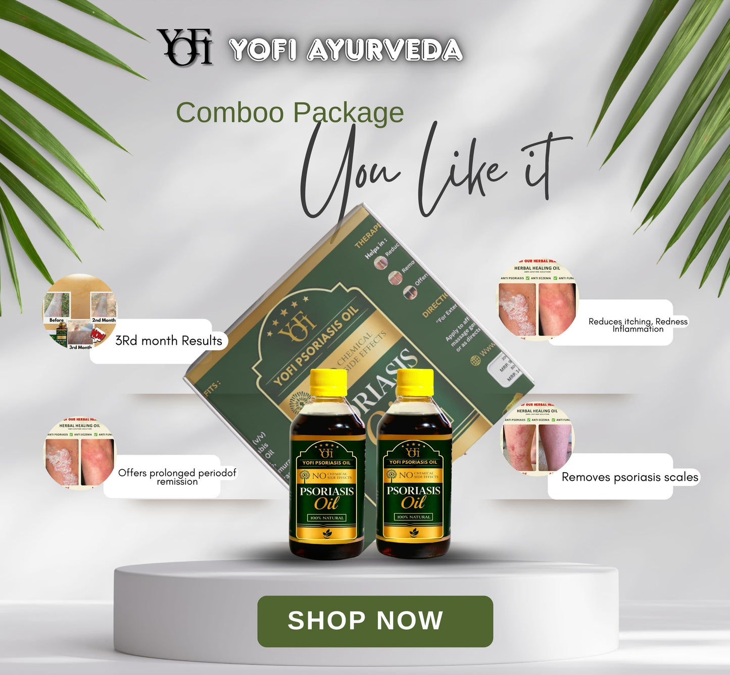 YOFI Herbal Psoriasis -Clearing Oil